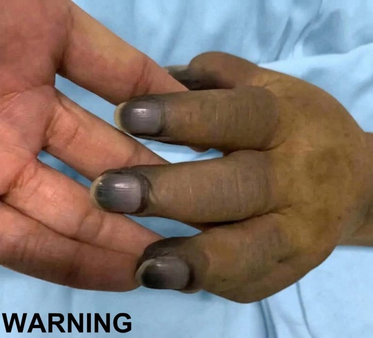 These are the consequences of painting your nails