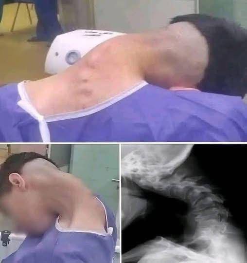 Young man hospitalized because he dropped his ca…