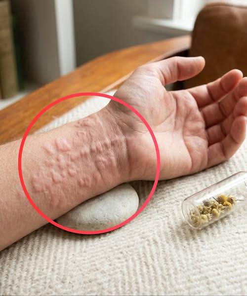 These are the consequences of sleeping with…