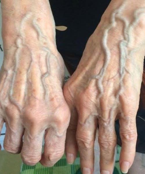 If your veins are visible in your hand, it is a signal.