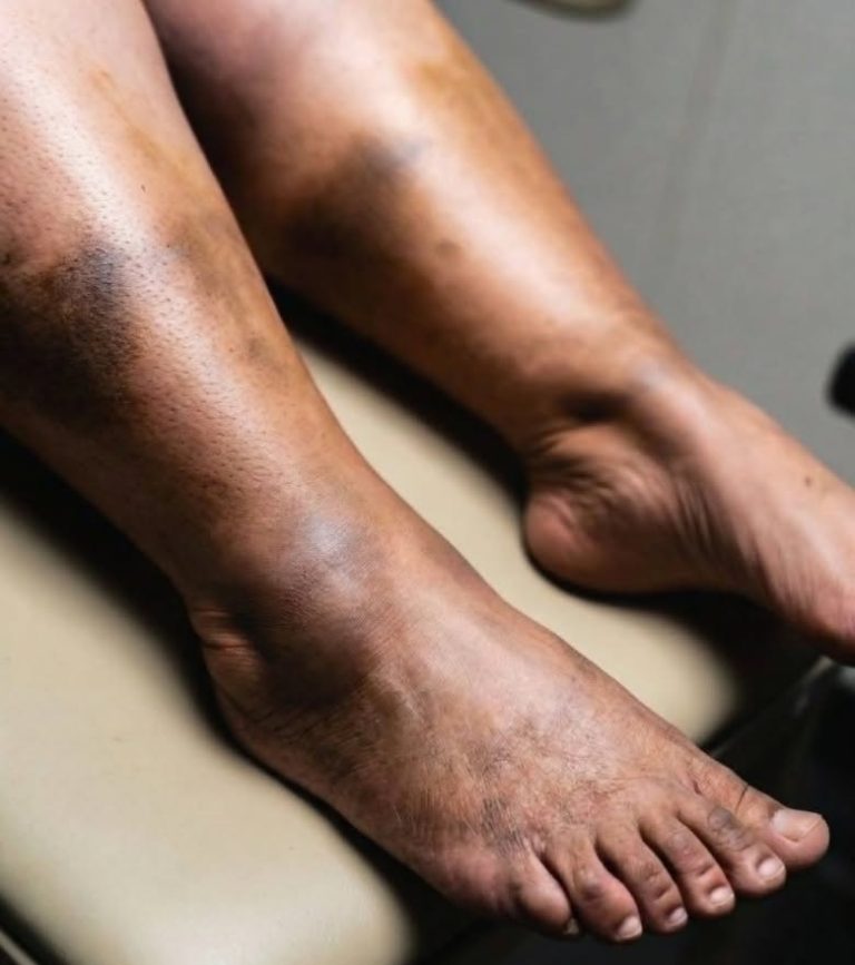 These are the consequences of sleeping with the…
