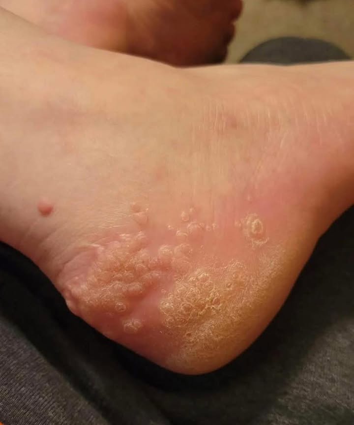 These are the consequences of sleeping with the…