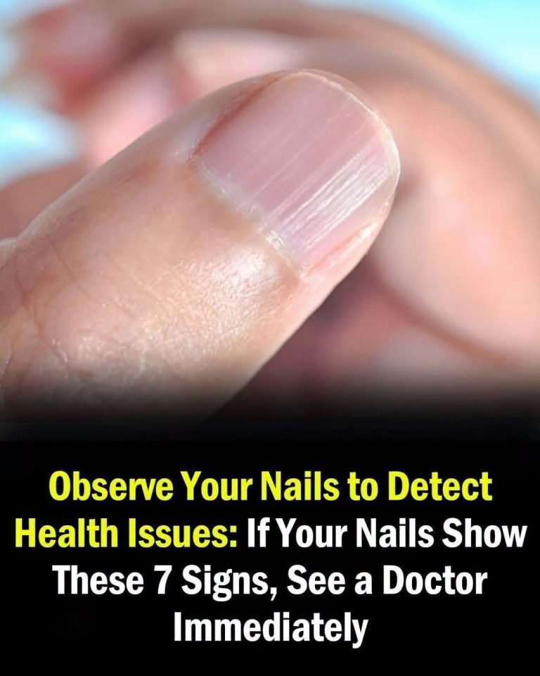 Having striped nails might be..